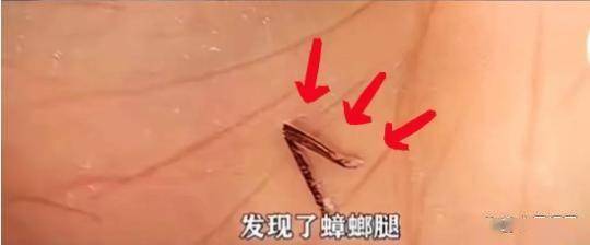 了比想象中的更加恶心难怪女性会得妇科病AG真人旗舰厅登录315晚会大爆雷出现(图20)